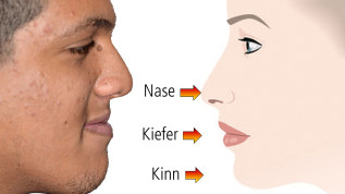 Konzept für kieferorthopädisch-kieferchirurgische Therapie