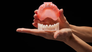 SprintRay: Dentaler 3-D Druck, neu definiert!