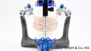 Möglichkeiten zur Bestimmung der vertikalen Dimension im Kausystem