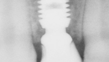 firstGalleryImage