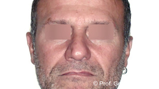 Digitale KFO im Fokus moderner 3D-DVT Diagnostik