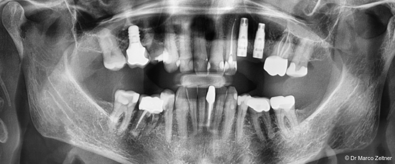 Fig. 10: Postoperative radiographic assessment.