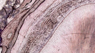 Zukunftsaufgabe: Alterndes Parodont
