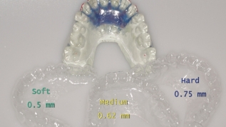 Das CLEAR-ALIGNER-Konzept nach Dr. Kim