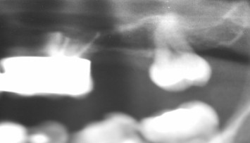 firstGalleryImage
