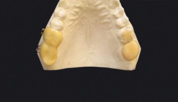 firstGalleryImage
