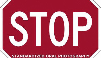 firstGalleryImage