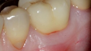 Moderne Endodontie - Ein Überblick