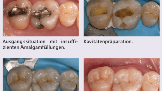 Ein bioökonomisch optimiertes Behandlungskonzept