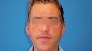 Chirurgie oder dentale Kompensation?