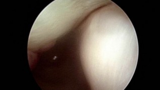 Kiefergelenkchirurgie