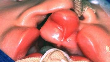 firstGalleryImage