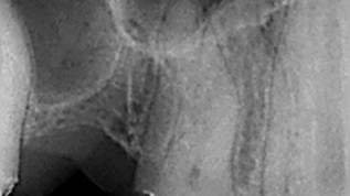 Endodontie heute