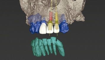 firstGalleryImage