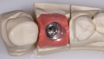 firstGalleryImage