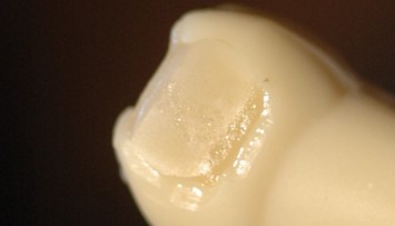firstGalleryImage