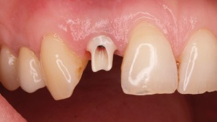 Langlebigkeit und ­natürliche Ästhetik
