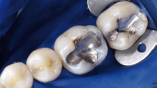 Ideale Materialkombination für optimale Ergebnisse