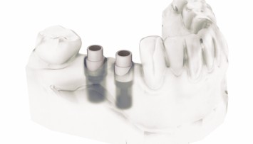 firstGalleryImage