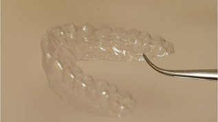 Aligner neuester Generation
