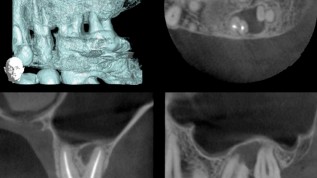 Klassische und neue Methoden in der Endodontie