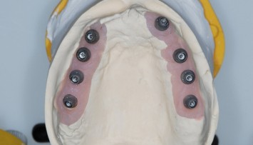 firstGalleryImage