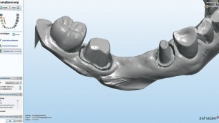 Lasersintern im digitalen Workflow