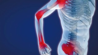Gesundheitsrisiken durch Komposite