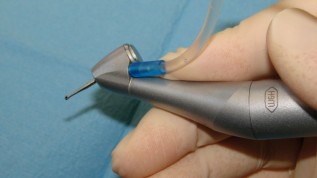 Vereinigung von Hand- und Winkelstück