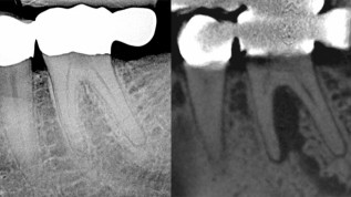 Eine neue Leitlinie zur dentalen DVT