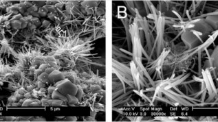 Universelles biokeramisches Obturationsmaterial