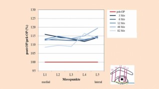 Morphologiebasierte Chirurgie im alternden Gesicht