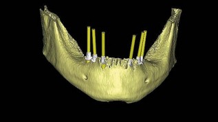 Smile 3D – Röntgendiagnostik 2.0