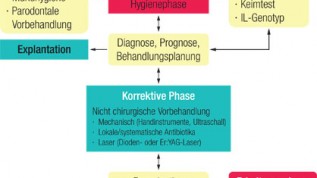 Schlüsselfaktor Er:YAG-Laser bei Periimplantitis