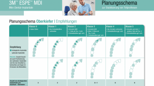 Mini-Implantate bieten vielseitige Optionen