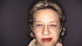 Stufenpläne in der Ästhetischen Dermatologie