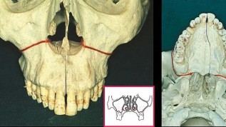 Änderung der skelettalen Strukturen im Gesicht