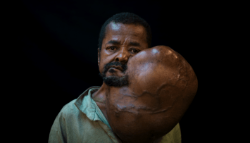 firstGalleryImage