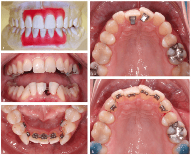 Asr Wo Liegen Die Grenzen Zwp Online Das Nachrichtenportal Fur Die Dentalbranche