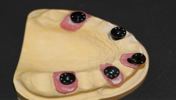 firstGalleryImage