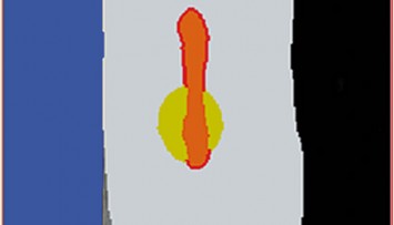 firstGalleryImage