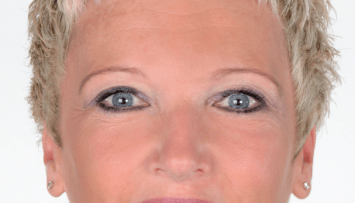 firstGalleryImage