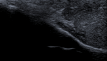 firstGalleryImage