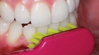 Das Einmaleins der häuslichen Mundhygiene
