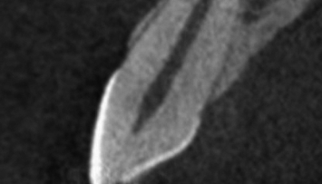 firstGalleryImage