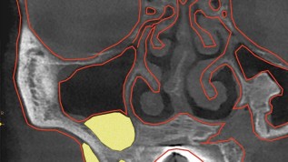Die biomechanische Stabilität