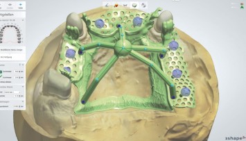 firstGalleryImage