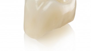 biodentis – Qualitätszahnersatz aus Keramik