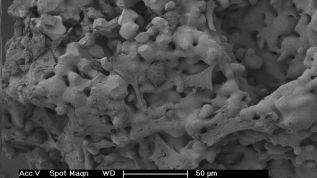 β-Tricalciumphosphat versus Hydroxylapatitkeramik