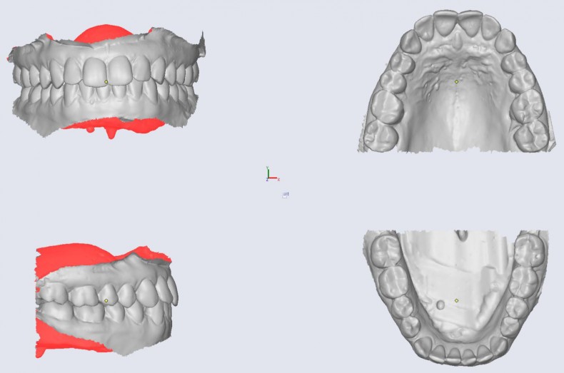 Digitaler Workflow in der kieferorthopädischen Praxis. KFO 2.0 – ZWP ...